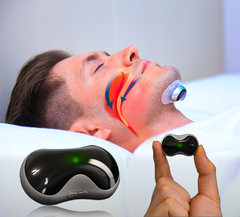 SilentEase Anti-Snoring Device – Smart Pulse Technology for Restful Sleep